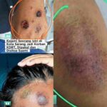Kejam! Istri di Kota Serang Diduga Jadi Korban KDRT, Alami Luka Serius di Tubuh dan Kepala InShot_20260401_141426181