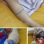 Kasus Sriwahyuni Terluka Akibat Mesin Tebas Kian Disorot, Mediamabespolri.com Desak Penyelesaian dan Penegakan Hukum